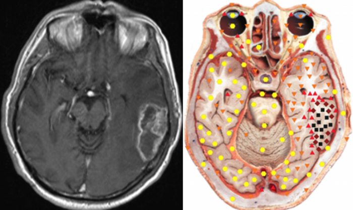 8D-NLS LRIS Diagnostic vs. MRI